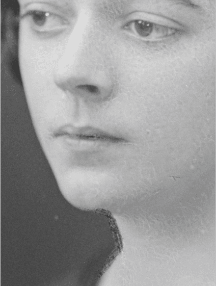 A closeup of the chin  of a woman, Mrs F. McDonald. The photo is black and white.